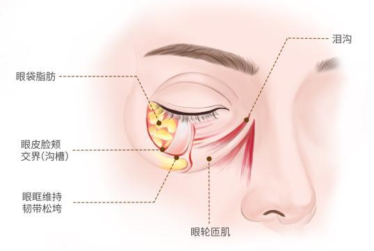 然衰老的标志去除眼袋焕发青春光彩九游会真